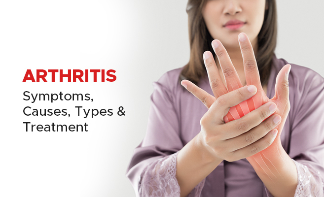 You are currently viewing Arthritis: Exploring Natural Remedies and Holistic Management